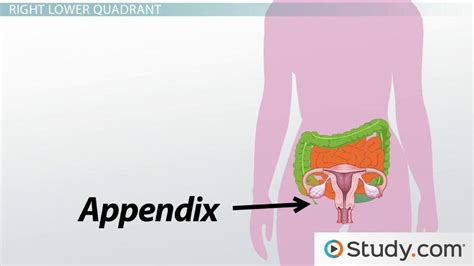 Diagnosis Of Abdominal Pain The Four Quadrants Video And Lesson