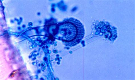 Aspergillus Fumigatus 100 X Download Scientific Diagram