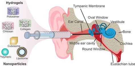 Middle Ear Pathology Causes Symptoms And Treatment Steve Gallik
