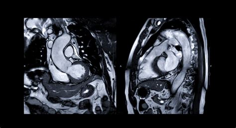 How Any Imaging Center Can Offer Cardiac Mri