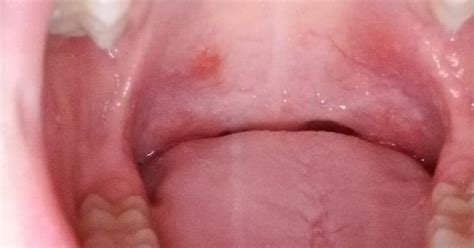 Sore Throatmouth Bumps Album On Imgur