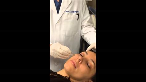 Micro Botox Using Aquagold Fine Touch By Dr David Goldberg Youtube