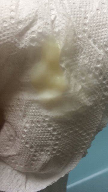 Can you tell if you're pregnant by checking your cervical mucus or vaginal discharge? Thick milky discharge at 14 weeks.tmi pic attached | Netmums