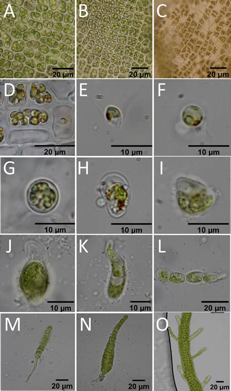 Ontogenetic Development Of Clonal Gametophytes Of Ulva Capillata After