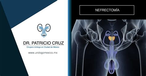 Prostatitis Dr Patricio Cruz Cirujano Ur Logo M Xico