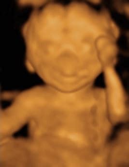 Check out our 3d ultrasound photo selection for the very best in unique or custom, handmade pieces from our shops. 3D Ultrasound Photo Gallery 14-20 Weeks | Baby Impressions ...