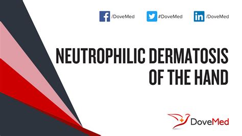 Neutrophilic Dermatosis Of The Hand