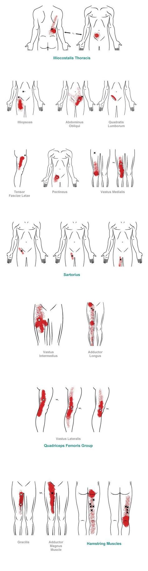 Trigger Point Referral Pain Pattern For The Groin And Thigh El Paso