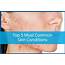 Top 5 Most Common Skin Conditions  Avail Dermatology