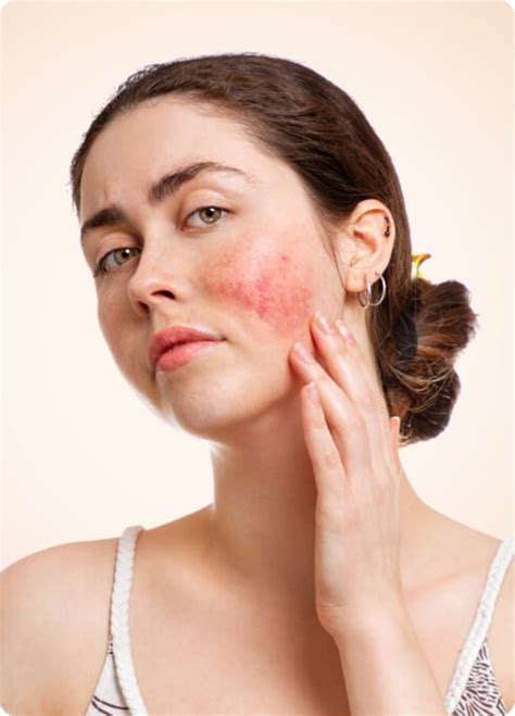 Rash Treatment Arlington Leading Dermatologist