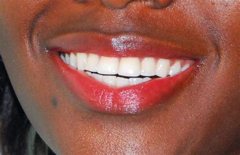 The major causes of toothache are related to tooth decay, caries, abscessed tooth. Human and Health Rights-Uganda: Why is dental pain worse ...
