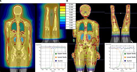 Frontiers Optimized Conformal Total Body Irradiation Methods With