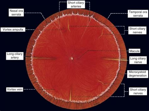 Retinal Detachment Ento Key