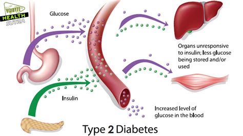Type 2 Diabetes Symptoms - YouTube