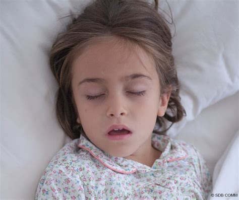 Pediatric Sleep Breathing Disorders Just Breathe Dds