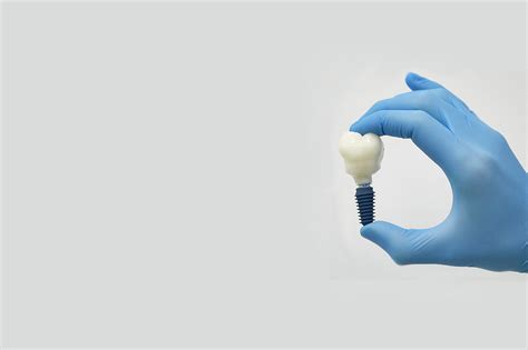 Everything You Need To Know About Dental Implants Prolident