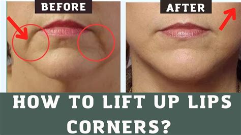 How To Lift Up Lips Corners Fix Droopy Mouth Corners Face Yoga And Massage Youtube