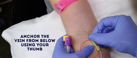 Venepuncture Osce How To Take Blood Venipuncture