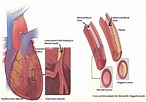 1 Cardiovascular diseases (a) Death of heart muscle leading to Angina ...