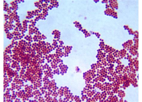 Gram Positive Cocci In Clusters Staph Aureus