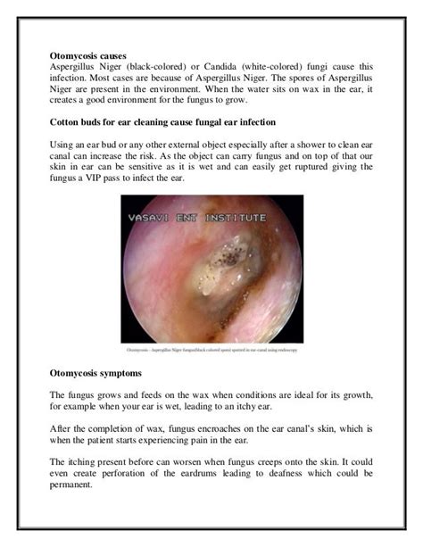 Otomycosis Ear Fungal Infection Causes Symptoms And Treatmentpdf