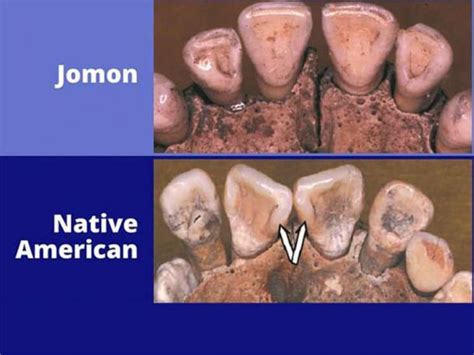 Study Of Ancient Teeth Reveals Native American Origins Lie In Siberia