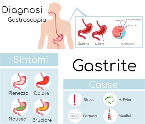Gastrite Sintomi Cause E Rimedi Centro Medico E Studio Sexiz Pix