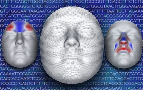 we scanned the dna of 8 000 people to see how facial features are controlled by genes upmc
