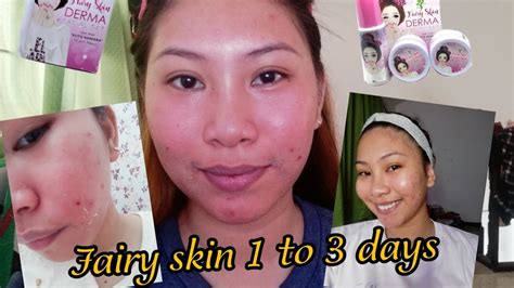 Fairy Skin Trial In 7 Days Youtube