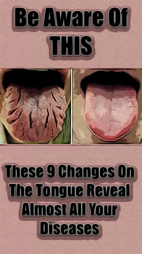 Be Aware Of This These 9 Changes On The Tongue Reveal Almost All Your