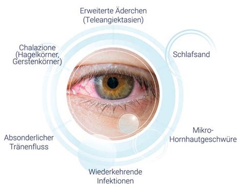 E Eye Behandlung Gegen Trockene Augen Sicca Syndrom