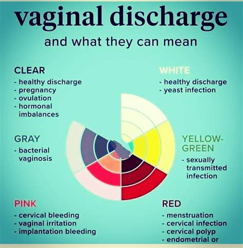 Causes De D Charge Vaginale Blanche Haute Californie