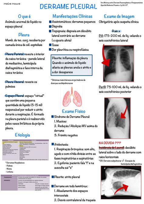 Resumo Derrame Pleural DERRAME PLEURAL O que é Acúmulo anormal de