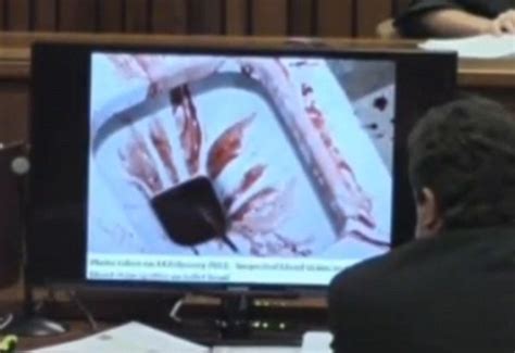 Photos Of A Shirtless Blood Stained Oscar Pistorious Immediately