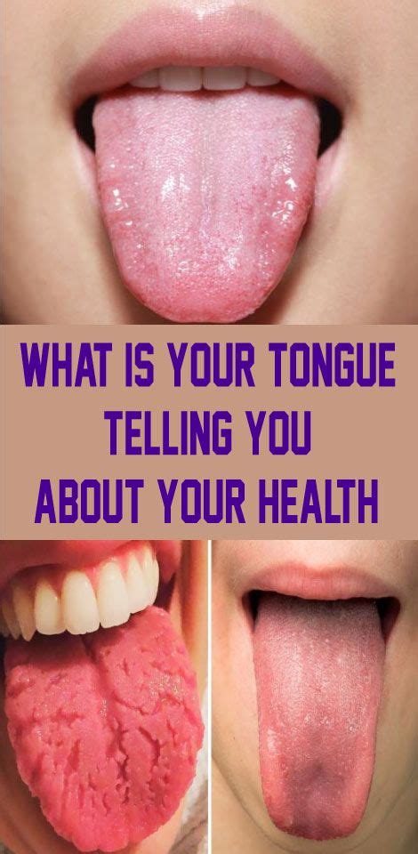 what is your tongue telling you about your health health health tips health remedies