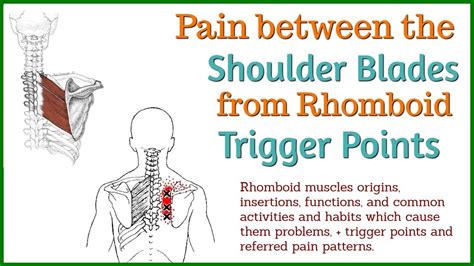 Pain Between Shoulder Blades Causes Treatment Vrogue Co