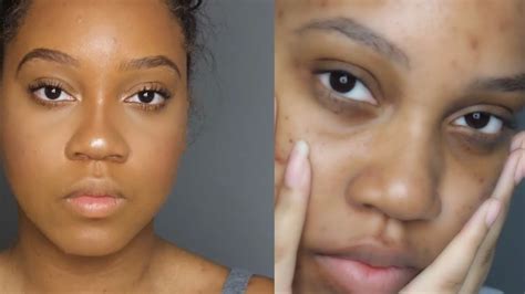 How To Conceal Deep Set And Dark Under Eyes Youtube