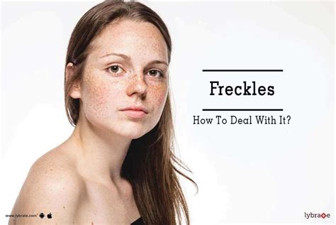Freckles How To Deal With It By Dr Nishant Jain Lybrate
