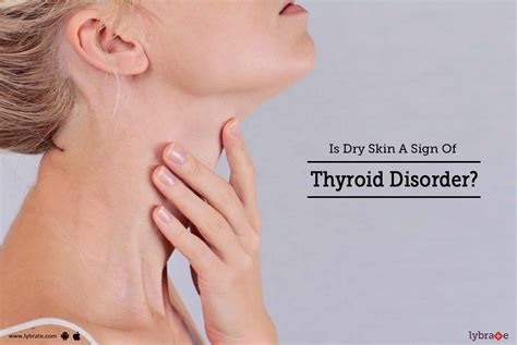 Is Dry Skin A Sign Of Thyroid Disorder By Dr Rizwan Khan Lybrate