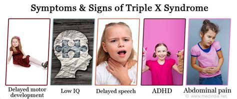 Triple X Syndrome Causes Symptoms Diagnosis Treatment Prevention