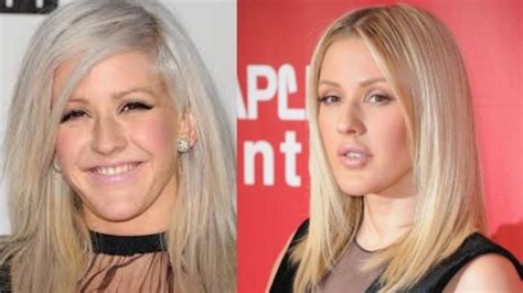 Did Ellie Goulding Get Plastic Surgery For Youthful Beauty