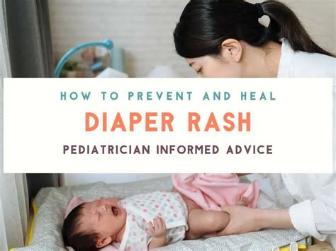 Diaper Rash Causes Prevention And When To Consult A Pediatrician
