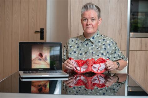 Woman Claims She Was Left With Gaping Hole In Her Chest Thanks To Tight