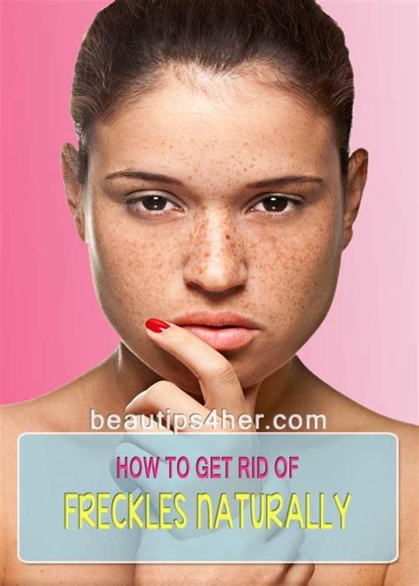 How To Get Rid Of Freckles Naturally Beauty And Makeup Tips Getting Rid Of Freckles Natural