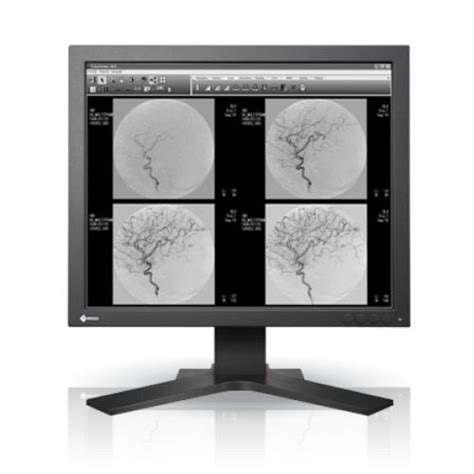 Determine your monitor's gamma value. 1MP Grayscale EIZO SMD19102D (SMD 19102 D) LCD MONITOR ...