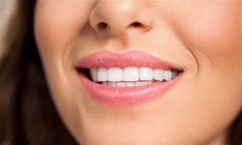 How To Close Gaps In Teeth With Braces Faster Gaps Between Teeth