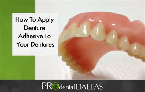 When To Use Denture Adhesive And How To Apply It Pro Dental Dallas