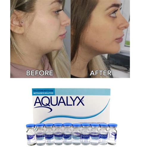 Aqualyx Fat Dissolving Injection With Best Price China Double Chin