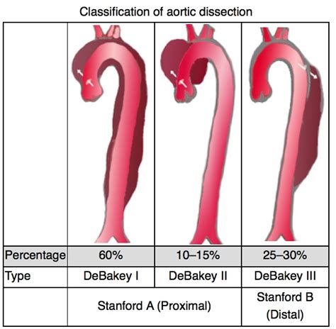 Aortic Dissection Classification Emcage