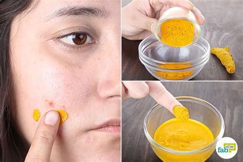 Can You Use Turmeric On Your Face Everyday Will You Be Trying This